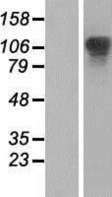 Western Blot: XRN2 Overexpression Lysate [NBP2-07470]