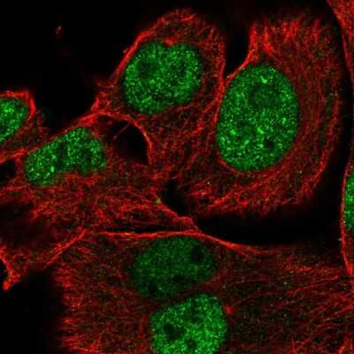 Immunocytochemistry/ Immunofluorescence: XRRA1 Antibody [NBP2-55013]