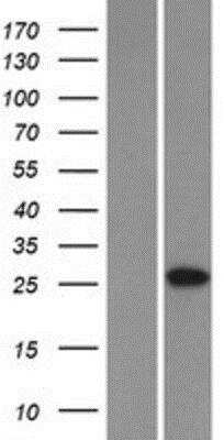 Western Blot: XTP12 Overexpression Lysate [NBP2-06161]