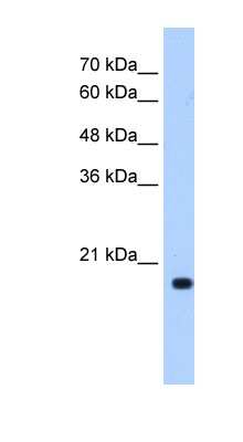 Western Blot: XTP3TPA Antibody [NBP1-55335]