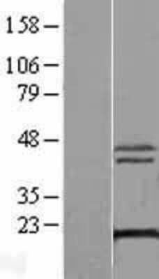 Western Blot: XTP3TPA Overexpression Lysate [NBL1-17921]