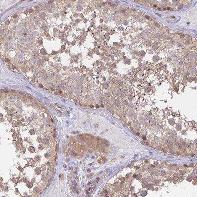 Immunohistochemistry-Paraffin: XTP4 Antibody [NBP2-34142]