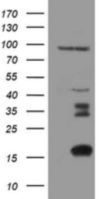 Western Blot: XTP4 Antibody (OTI2D5)Azide and BSA Free [NBP2-74904]