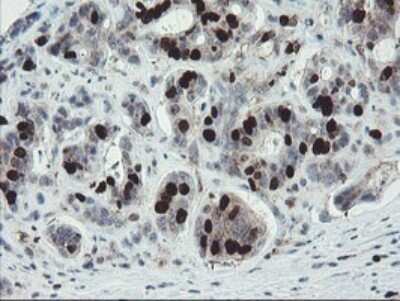 Immunohistochemistry: XTP4 Antibody (OTI2D5) [NBP2-46592]