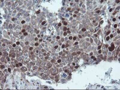 Immunohistochemistry: XTP4 Antibody (OTI2D5) [NBP2-46592]