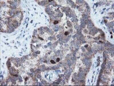 Immunohistochemistry: XTP4 Antibody (OTI2D5) [NBP2-46592]