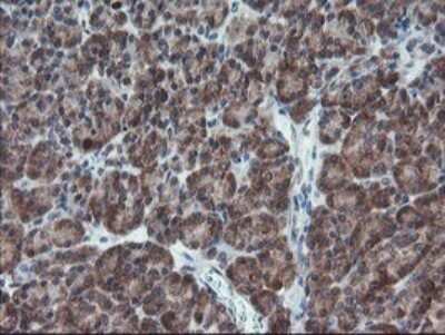 Immunohistochemistry: XTP4 Antibody (OTI2D5) [NBP2-46592]