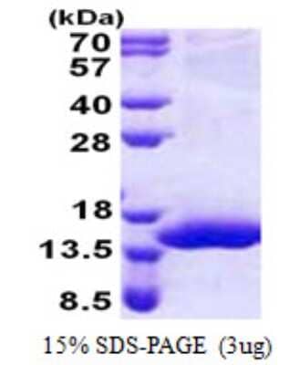 SDS-PAGE: Recombinant Human XTP4 His Protein [NBP2-23236]