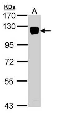 Western Blot: XYLT2 Antibody [NBP1-33208]