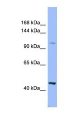 Western Blot: XYLT2 Antibody [NBP1-69321]