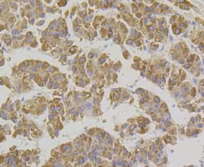 Immunohistochemistry-Paraffin: Xanthine Oxidase Antibody (JG38-40) [NBP2-75717]