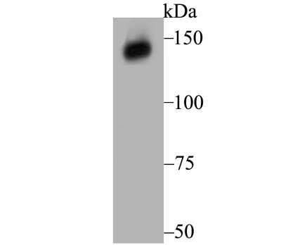 Western Blot: Xanthine Oxidase Antibody (JG38-40) [NBP2-75717]