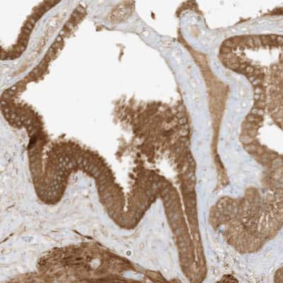 Immunohistochemistry-Paraffin: Xrn1 Antibody [NBP1-89420]