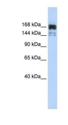 Western Blot: Xrn1 Antibody [NBP1-57281]