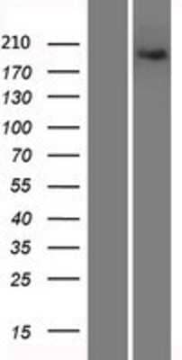 Western Blot: Xrn1 Overexpression Lysate [NBP2-06746]