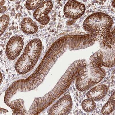 Immunohistochemistry-Paraffin: Xylulokinase/XYLB Antibody [NBP1-87919]