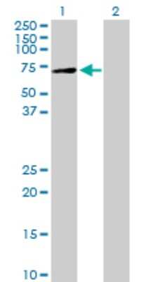 Western Blot: Xylulokinase/XYLB Antibody [H00009942-B01P]