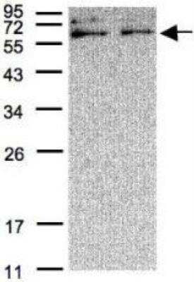 Western Blot: Xylulokinase/XYLB Antibody [NBP1-31095]