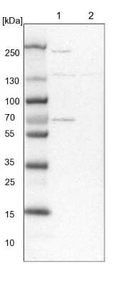 Western Blot: Xylulokinase/XYLB Antibody [NBP1-87919]