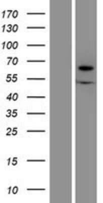 Western Blot: Xylulokinase/XYLB Overexpression Lysate [NBP2-10523]