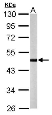 Western Blot: YANK2 Antibody [NBP1-32343]