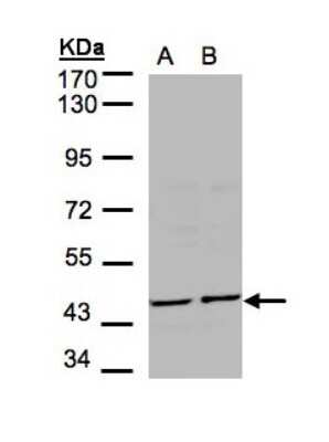 Western Blot: YANK2 Antibody [NBP1-32343]