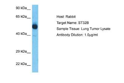 Western Blot: YANK2 Antibody [NBP3-09350]