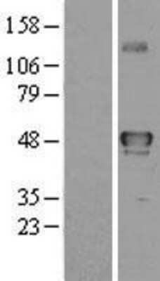 Western Blot: YANK2 Overexpression Lysate [NBL1-16550]