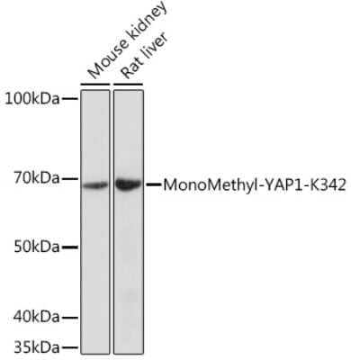 Western Blot: YAP1 [Monomethyl Lys342] AntibodyAzide and BSA Free [NBP3-15578]