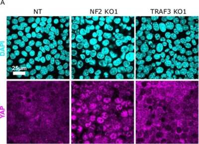 Immunocytochemistry/ Immunofluorescence: YAP1 Antibody - BSA Free [NB110-58358]