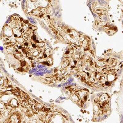 Immunohistochemistry-Paraffin: YAP1 Antibody - BSA Free [NB110-58358]