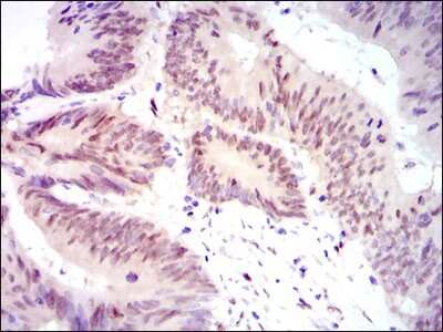 Immunohistochemistry-Paraffin: YAP1 Antibody (1A12) - BSA Free [NBP2-22117]