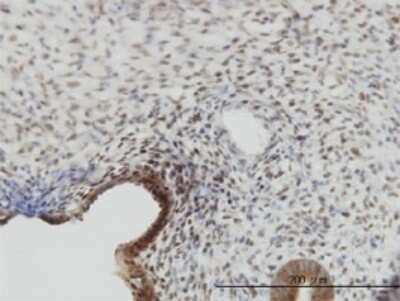 Immunohistochemistry-Paraffin: YAP1 Antibody (2F12) - Isoform 5 [H00010413-M01]