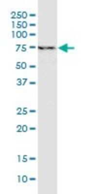 Western Blot: YAP1 Antibody (2F12)Isoform 5 [H00010413-M01]