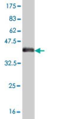Western Blot: YAP1 Antibody (2F12)Isoform 5 [H00010413-M01]