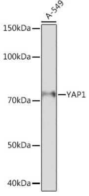 Western Blot: YAP1 Antibody (10G4S10) [NBP3-15685]