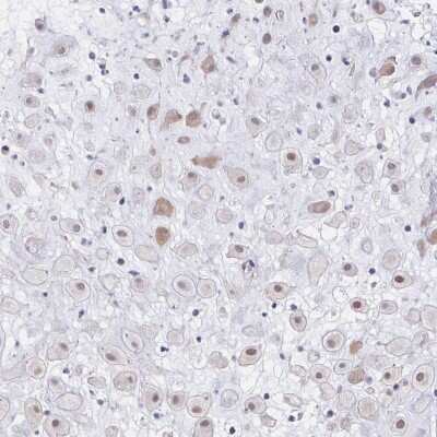 Immunohistochemistry-Paraffin: YAP1 Antibody [NBP2-38430]