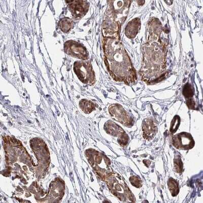 Immunohistochemistry-Paraffin: YAP1 Antibody [NBP2-38430]
