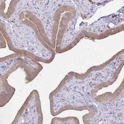 Immunohistochemistry-Paraffin: YAP1 Antibody [NBP2-38430]
