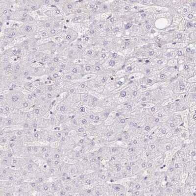 Immunohistochemistry-Paraffin: YAP1 Antibody [NBP2-38430]