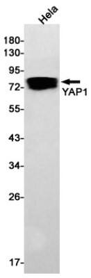 Western Blot: YAP1 Antibody (S06-5E9) [NBP3-19805]