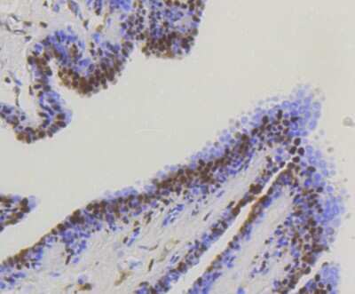 Immunohistochemistry-Paraffin: YAP1 Antibody (SU33-06) [NBP2-67467]