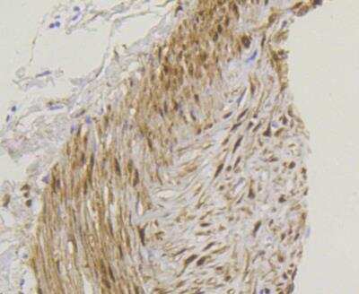 Immunohistochemistry-Paraffin: YAP1 Antibody (SU33-06) [NBP2-67467]