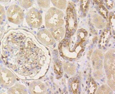 Immunohistochemistry-Paraffin: YAP1 Antibody (SU33-06) [NBP2-67467]