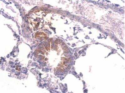 Immunohistochemistry-Paraffin: YARS Antibody [NBP1-32551]