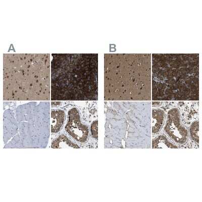 Immunohistochemistry-Paraffin: YARS Antibody [NBP1-86889]