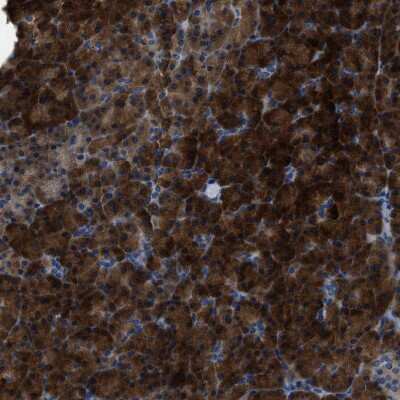 Immunohistochemistry-Paraffin: YARS Antibody [NBP1-86889]
