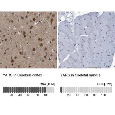 Immunohistochemistry-Paraffin: YARS Antibody [NBP1-86889]