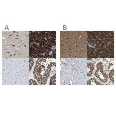 Immunohistochemistry-Paraffin: YARS Antibody [NBP1-86890]