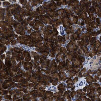 Immunohistochemistry-Paraffin: YARS Antibody [NBP1-86890]